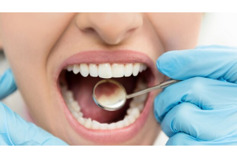 علایم شایع بیماری دهان و دندان و درمان آن 
