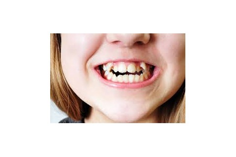 دلایل نامرتبی دندان های